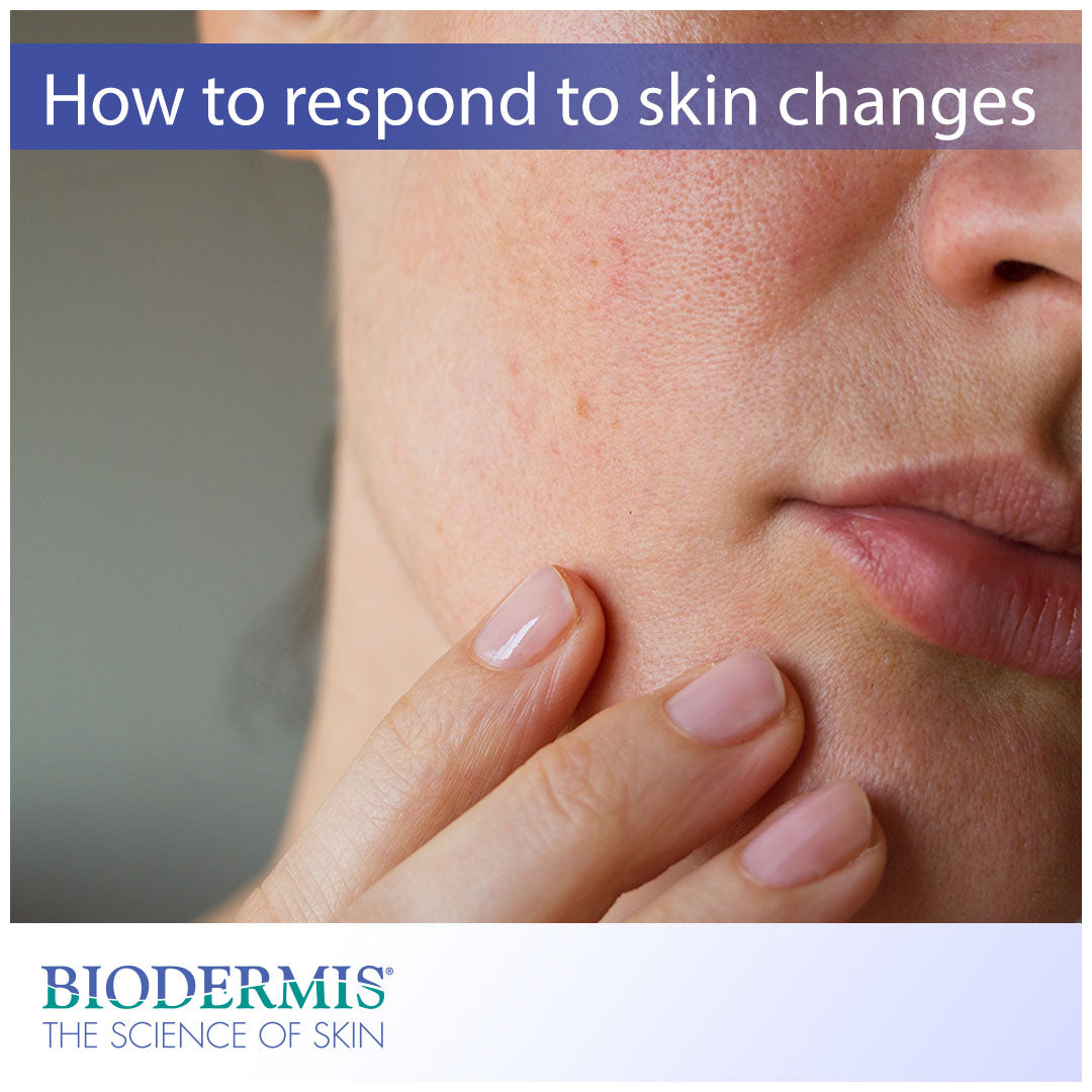 Understanding Skin Changes and How to Respond  |  Biodermis.com Biodermis