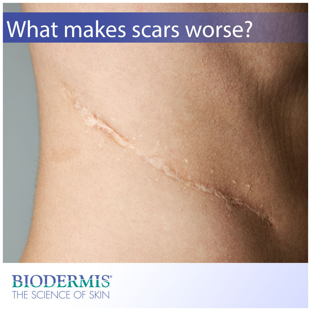 What Makes Scars Look Worse? | Biodermis.com Biodermis