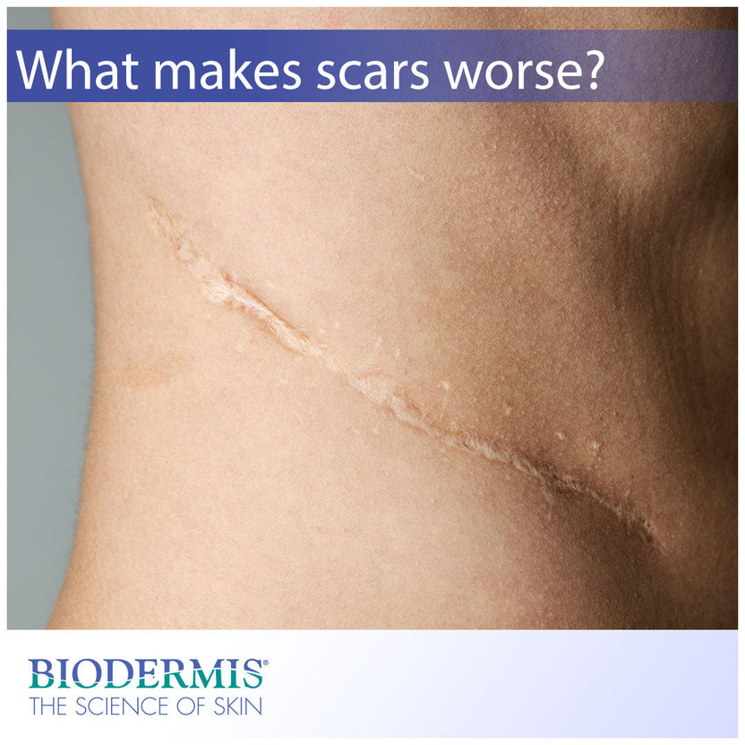 What Makes Scars Look Worse?