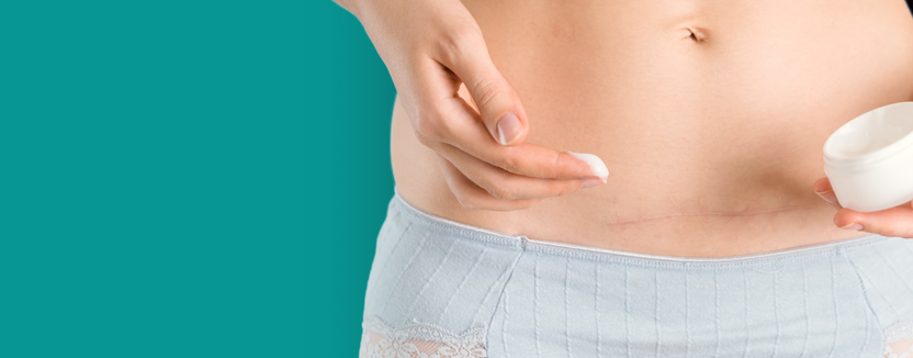 What Are Scars and How Do They Form? – Biodermis
