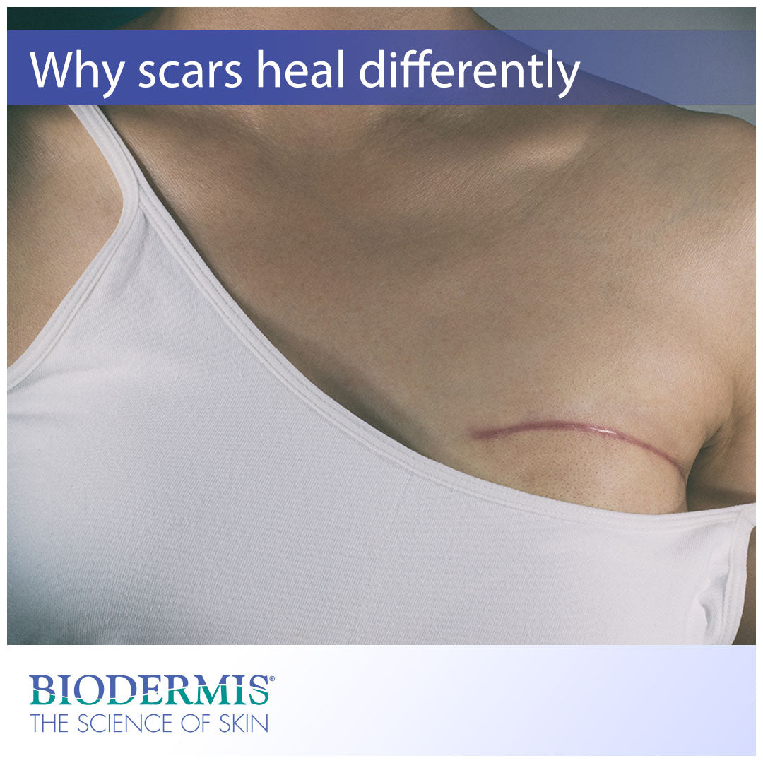 Why Do Some Parts of the Body Scar More Than Others?  |  Biodermis.com Biodermis