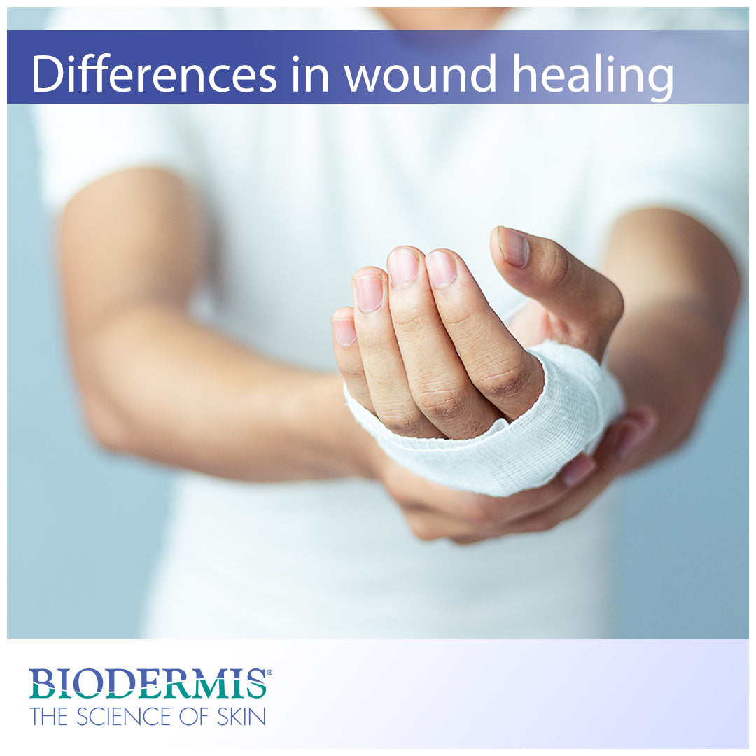 Why Some Wounds Heal Differently Than Others | Biodermis.com Biodermis