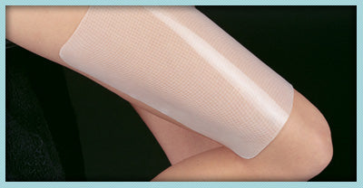 Laser Tattoo Removal Recovery