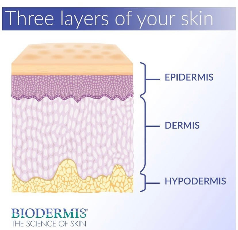 Bundle: Epi-Derm Areopexy Package
