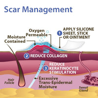 Epi-Derm Mastopexy (1 Pair)